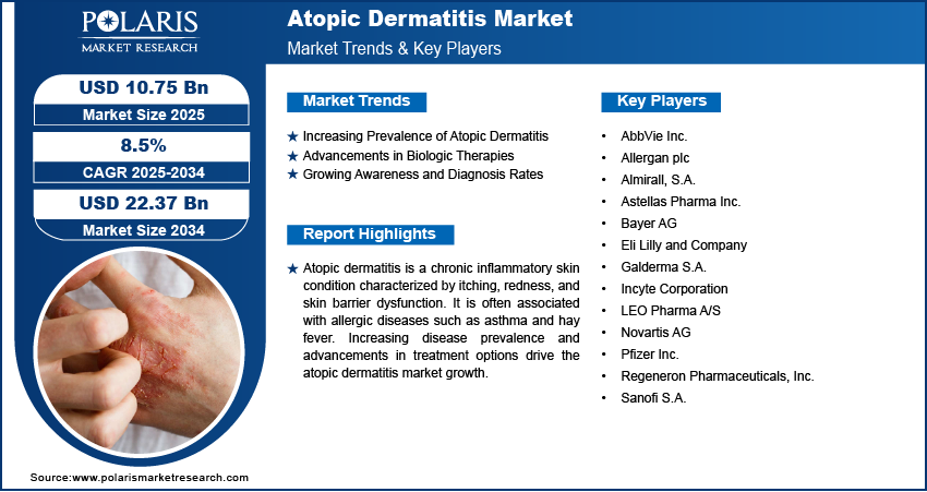 Atopic Dermatitis